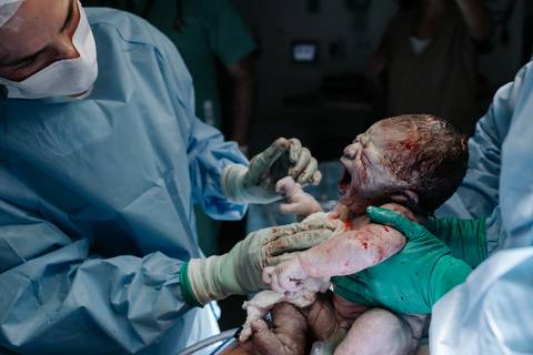Registro do momento exato do nascimento, com o médico segurando o bebê chorando.'