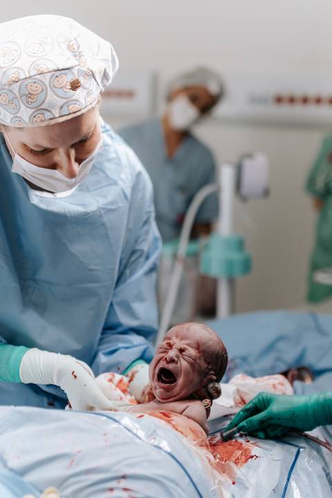Registro do momento exato do nascimento do primeiro gêmeo, chorando nos braços do médico.'