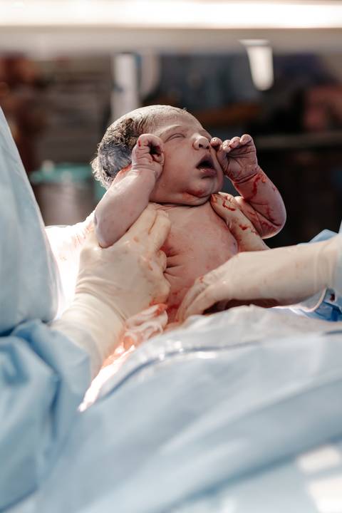 Momento exato em que recém nascido é tirado da barriga da mãe. '
