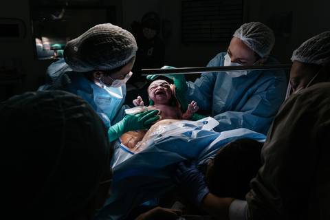 Momento do nascimento no parto cesárea humanizada'