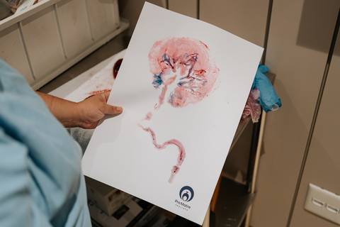 Ilustração da placenta e do bebê, apresentada pela equipe médica após o nascimento.'