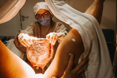 fotografia de parto humanizado em santos'