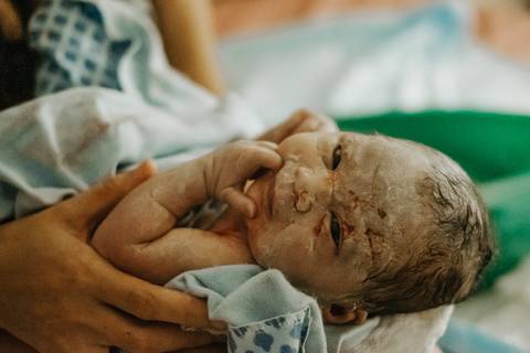 parto domiciliar em santos'