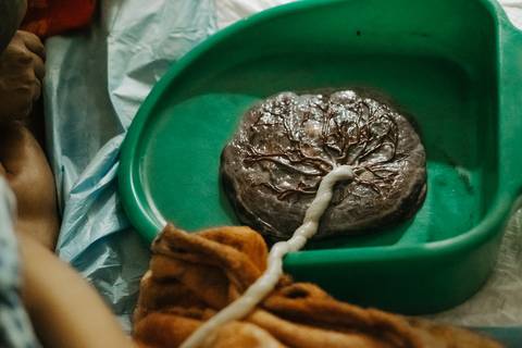 fotografia de parto domiciliar'