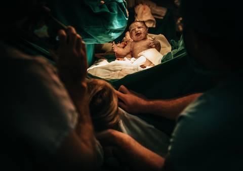 bebê nascendo'
