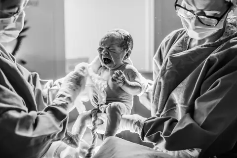 primeira foto do bebê durante seu nascimento'