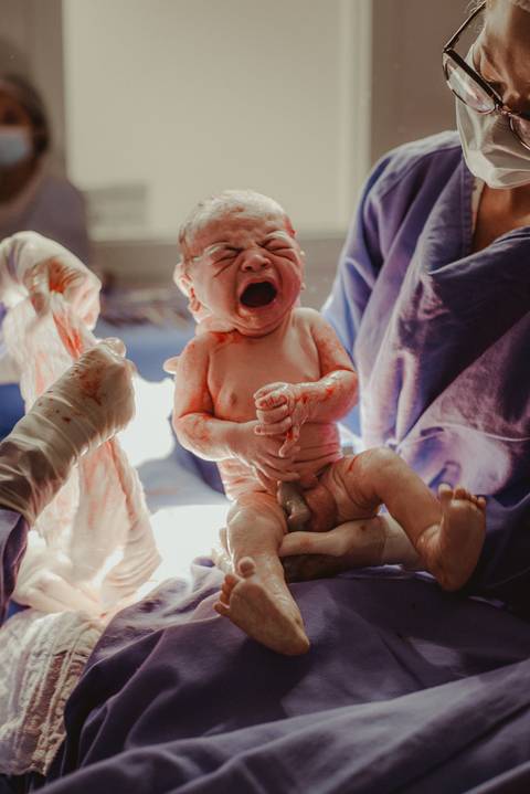 pequeno Evan nas mãos da médica obstetra no parto cesárea realizado em Bento Gonçalves no hospital Tacchini'