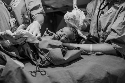 primeiros cuidados com o recém-nascido após nascimento'