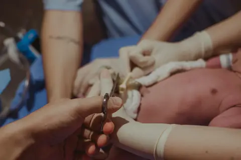 papai fazendo corte do cordão / coto umbilical'