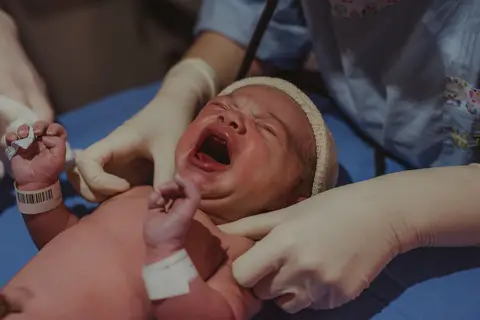 bebê chorando após nascimento '
