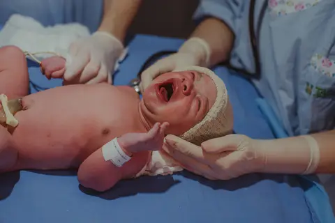 bebê chorando, nas mãos da pediatra logo após nascimento'