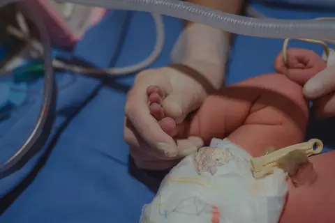 pézinho do bebê e cordão umbilical clampeado'