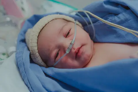 bebê recém-nascido com máscara de oxigênio logo após o nascimento'