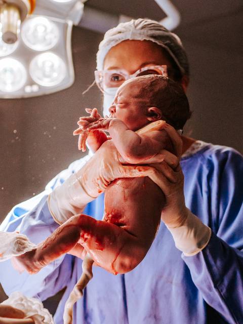 Primeiro contato visual com o bebê após o nascimento, fotografia de parto cesariana em Bento Gonçalves.'