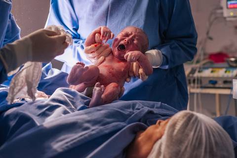 Recém-nascida chorando nos primeiros segundos de vida durante cesariana, fotografia de nascimento.'