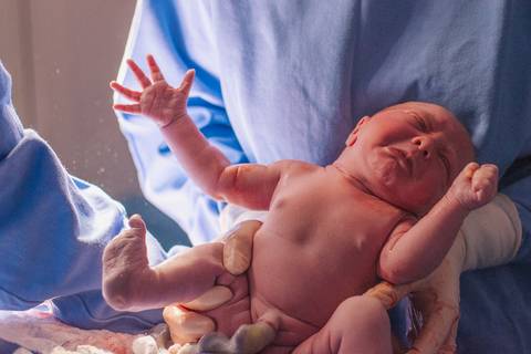 Recém-nascida nos braços da equipe médica logo após o parto, fotografia documental de nascimento.'