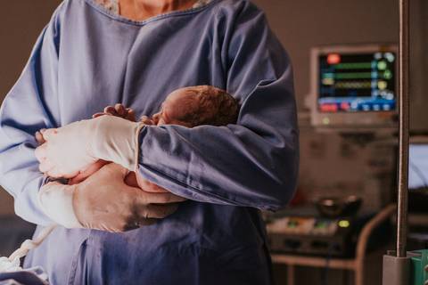 Bebê sendo aquecida após o nascimento durante cesariana, fotografia de parto hospitalar.'