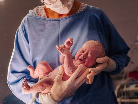 Recém-nascida sendo acolhida pela equipe médica após o parto, fotografia de nascimento humanizada.'
