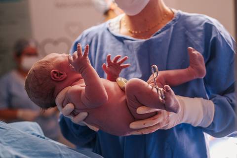 Bebê recém-nascida nos braços da equipe médica após o parto cesariana, fotografia de nascimento em Bento Gonçalves RS.'