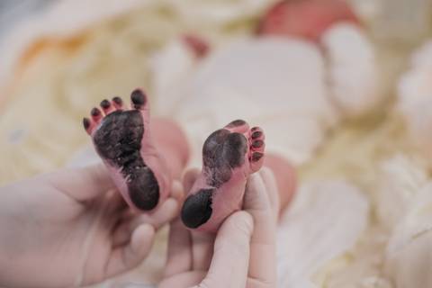 Detalhe dos pés da recém-nascida logo após o nascimento, fotografia de parto hospitalar em Bento Gonçalves RS.'