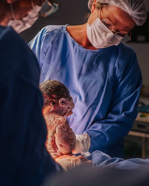 Recém-nascido sendo acolhido pela equipe médica logo após o nascimento no Hospital Tacchini.'