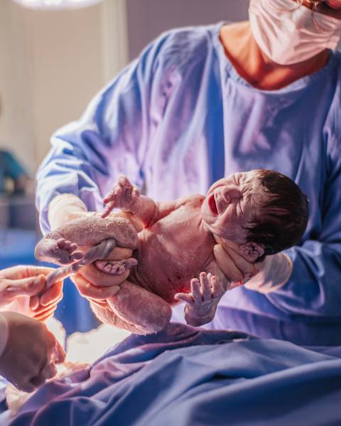 Primeiros instantes do recém-nascido após o parto, sendo segurado pela equipe médica em sala de parto hospitalar.'