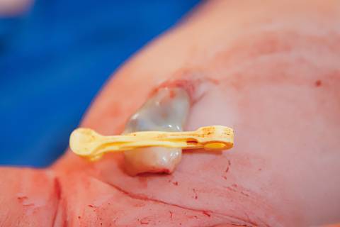 Fotografia de Nascimento'