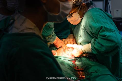 fotografia de parto'