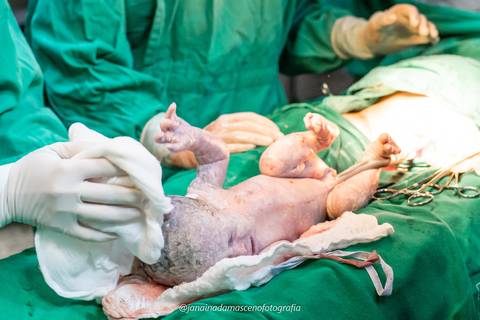 fotografia de parto'