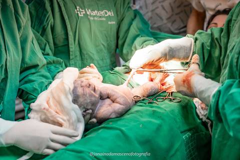 fotografia de parto'