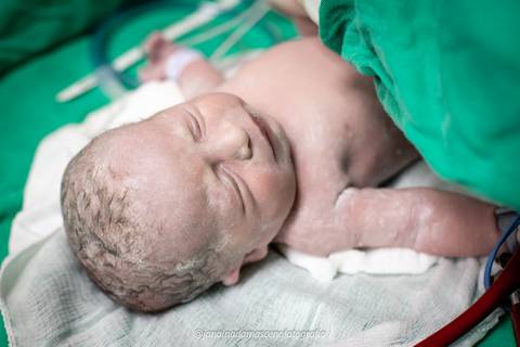 fotografia de parto'