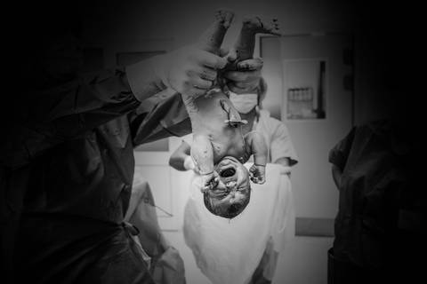 Fotografia Parto Lisboa - Cachopos Photography'