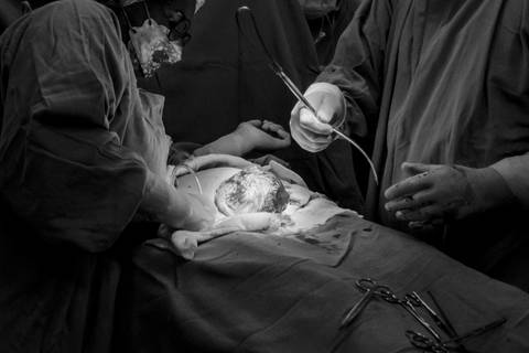 Nascimento do bebê na Maternidade - Hospital Salvalus '