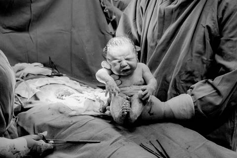 Nascimento do bebê na Maternidade - Hospital Salvalus '