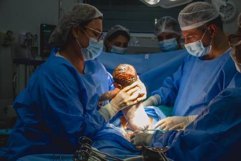 Fotografia de parto na Perinatal da Barra - RJ'
