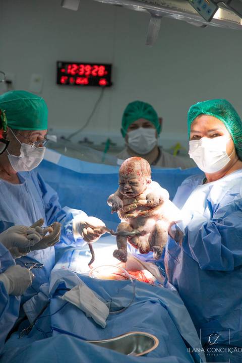 Artur chegou para multiplicar o amor da família. Para Alice, um irmão para a vida toda; para Priscila e Davi, um novo capítulo cheio de emoção; para avós e familiares, a alegria de ver a história continuar.'