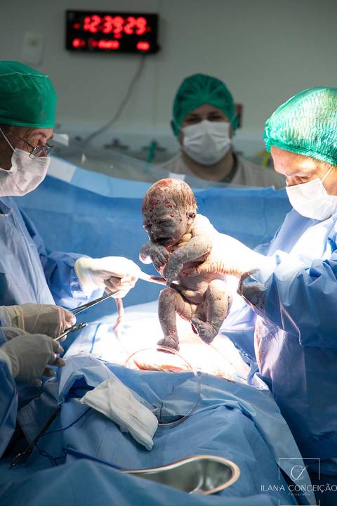 Artur chegou para multiplicar o amor da família. Para Alice, um irmão para a vida toda; para Priscila e Davi, um novo capítulo cheio de emoção; para avós e familiares, a alegria de ver a história continuar.'