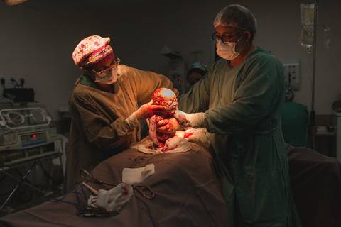 fotografia infantil gestante parto cesariana criança newborn hospital taubaté 10 de julho pinda maternidade centro cirurgico'