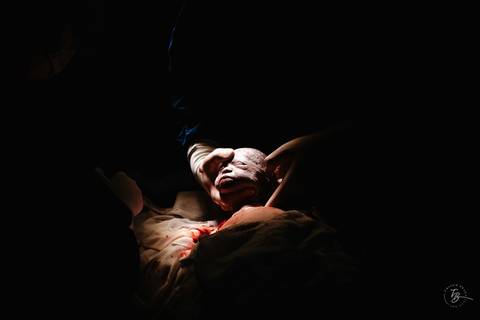 Fotografia de parto na maternidade Ilha em Florianópolis, cesárea, registros por Thiago Braga fotografia'