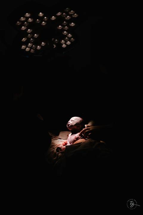 Fotografia de parto na maternidade Ilha em Florianópolis, cesárea, registros por Thiago Braga fotografia'