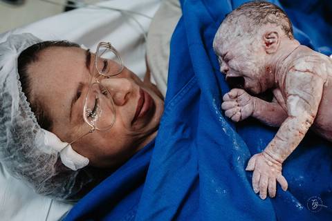 Fotografia de parto na maternidade Ilha em Florianópolis, cesárea, registros por Thiago Braga fotografia'