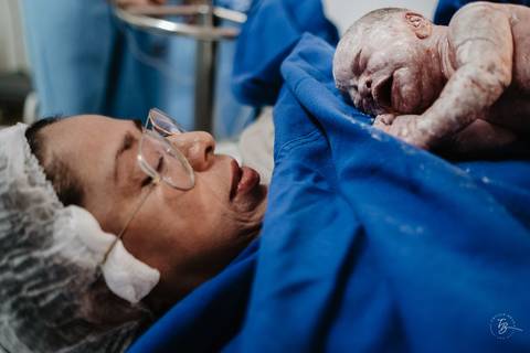 Fotografia de parto na maternidade Ilha em Florianópolis, cesárea, registros por Thiago Braga fotografia'