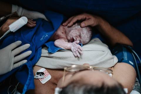 Fotografia de parto na maternidade Ilha em Florianópolis, cesárea, registros por Thiago Braga fotografia'