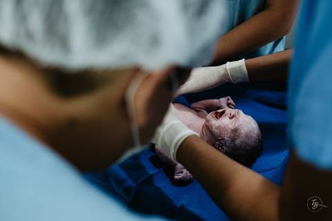 Fotografia de parto na maternidade Ilha em Florianópolis, cesárea, registros por Thiago Braga fotografia'