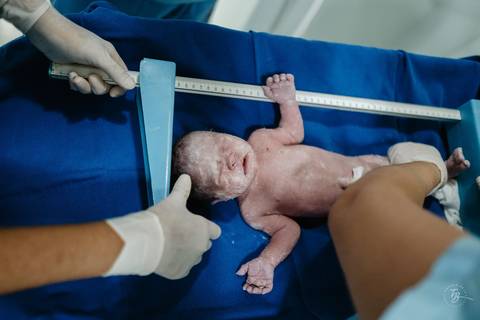 Fotografia de parto na maternidade Ilha em Florianópolis, cesárea, registros por Thiago Braga fotografia'