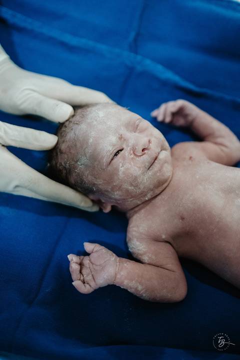 Fotografia de parto na maternidade Ilha em Florianópolis, cesárea, registros por Thiago Braga fotografia'