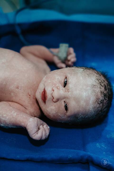 Fotografia de parto na maternidade Ilha em Florianópolis, cesárea, registros por Thiago Braga fotografia'