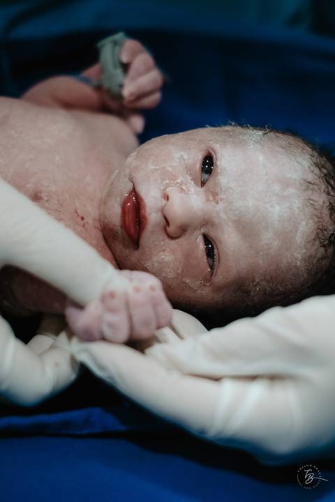 Fotografia de parto na maternidade Ilha em Florianópolis, cesárea, registros por Thiago Braga fotografia'