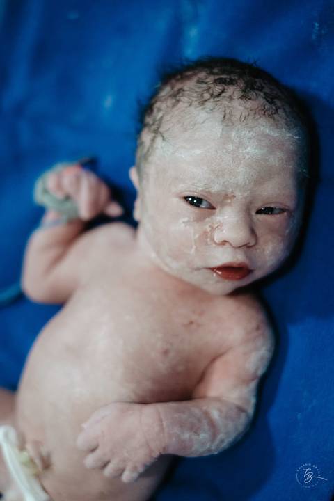 Fotografia de parto na maternidade Ilha em Florianópolis, cesárea, registros por Thiago Braga fotografia'