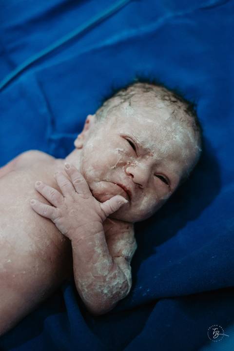 Fotografia de parto na maternidade Ilha em Florianópolis, cesárea, registros por Thiago Braga fotografia'
